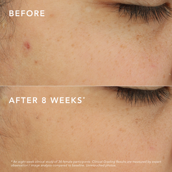 c-bright-dark-spot-corrector